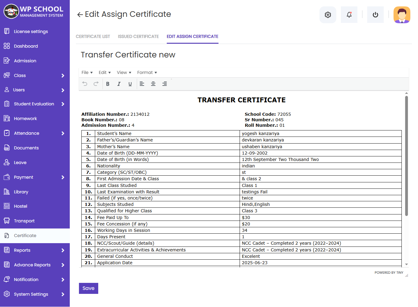 display content of the invoice