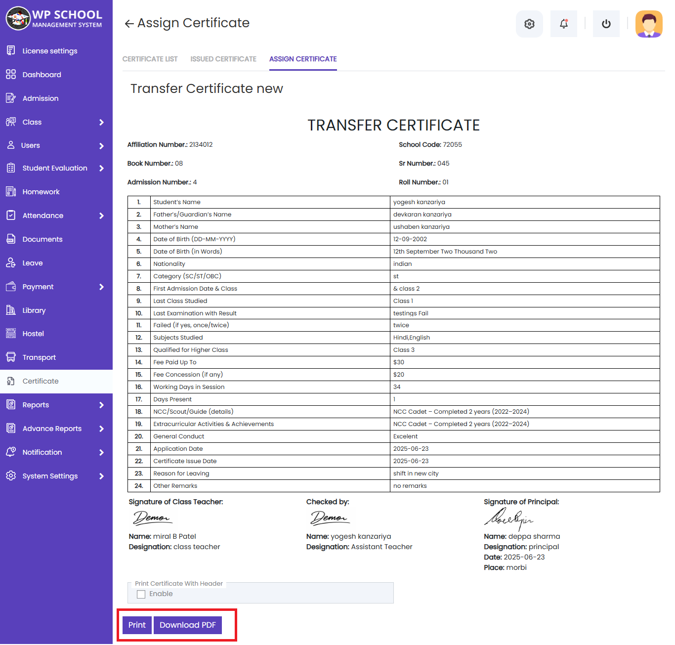 display content of the invoice